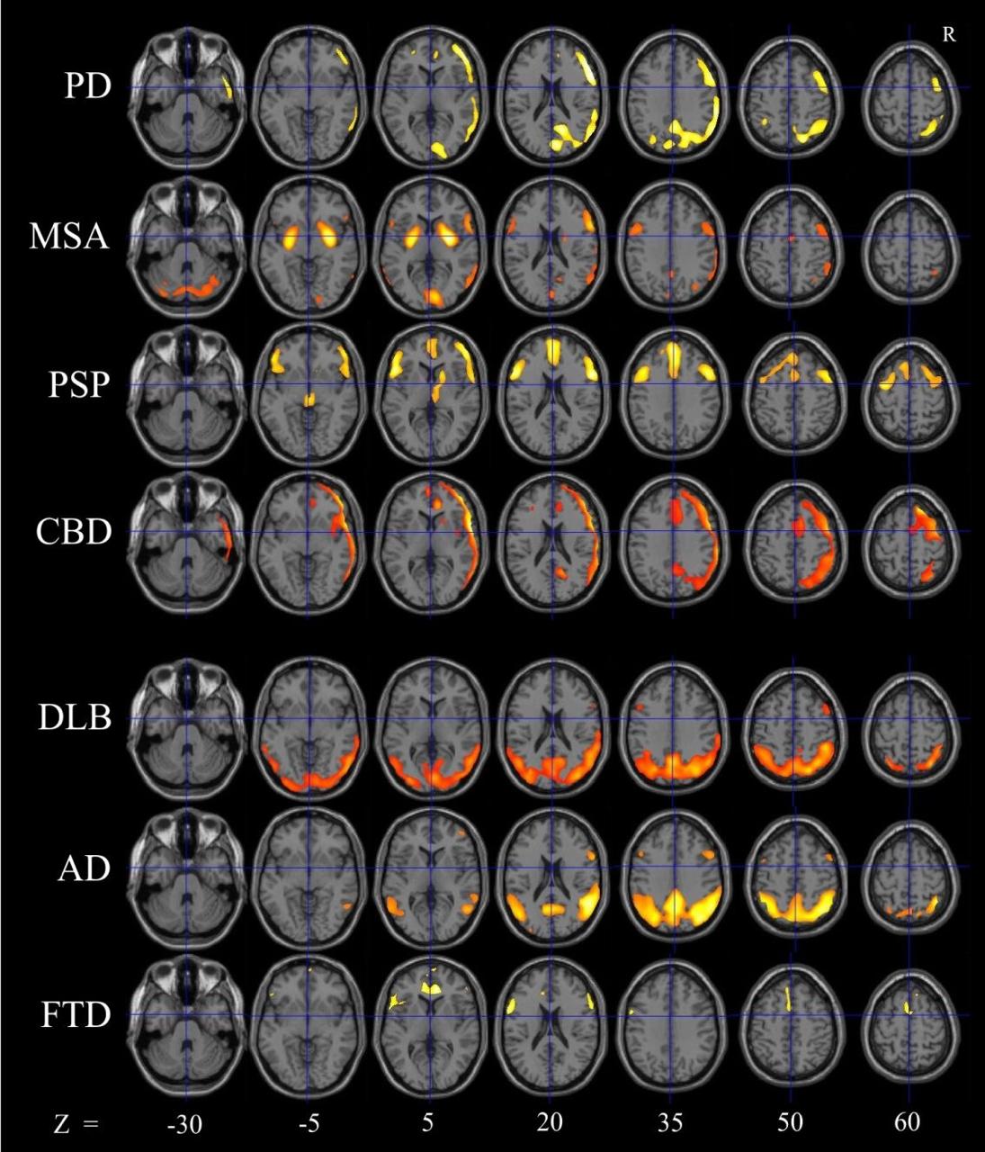 Virtual fMRI neuroscience thumbnail